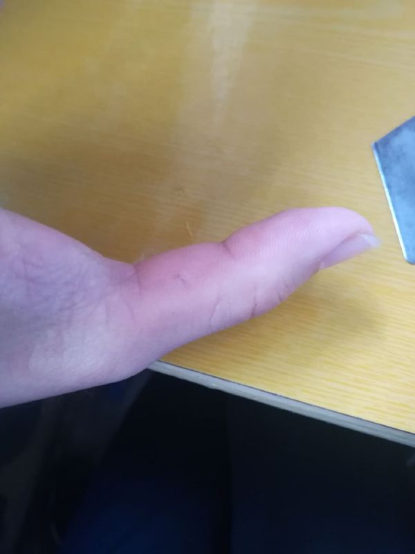 以牙还牙